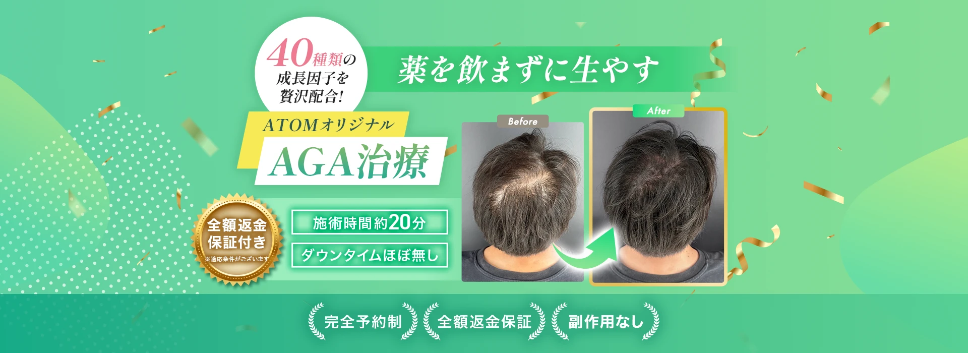 ATOMオリジナルAGA治療