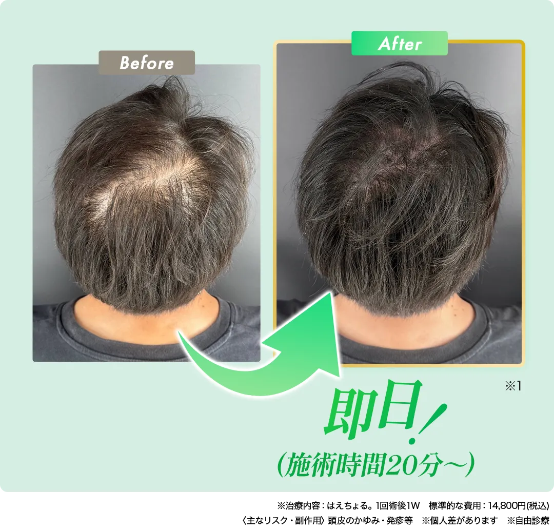 BeforeAfter