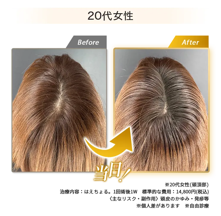 女性20代