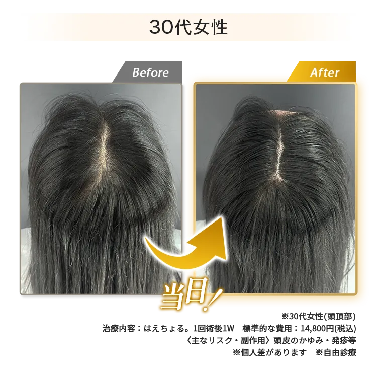 女性30代