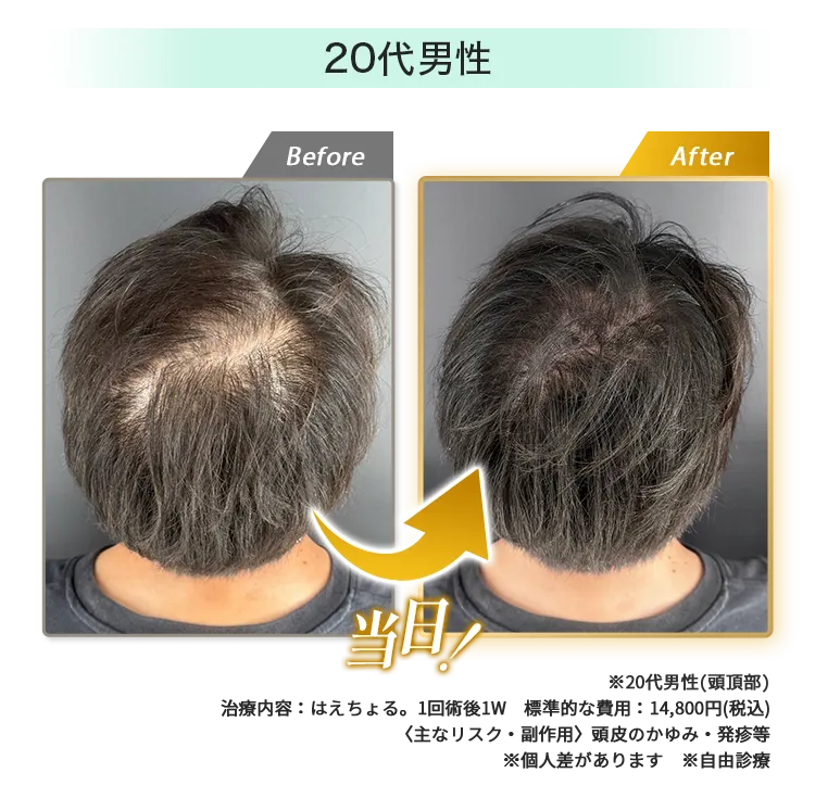 男性20代
