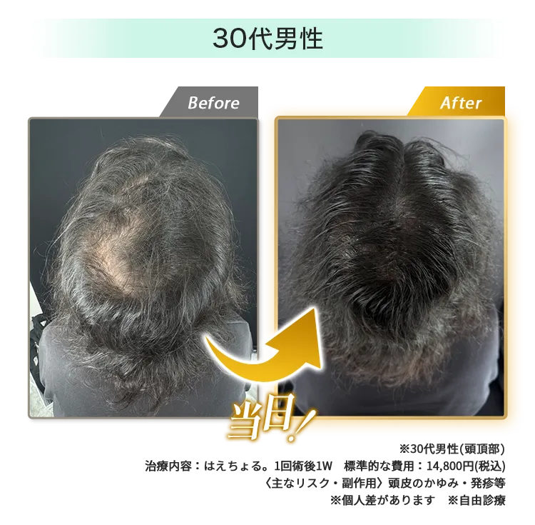男性30代