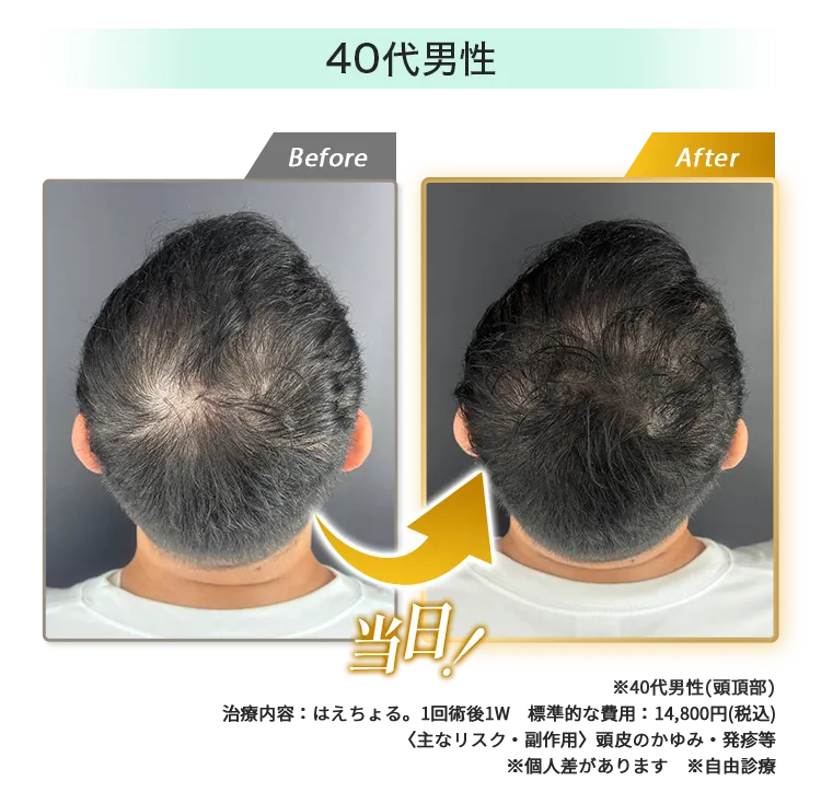 男性40代