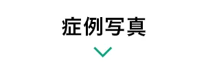 症例写真