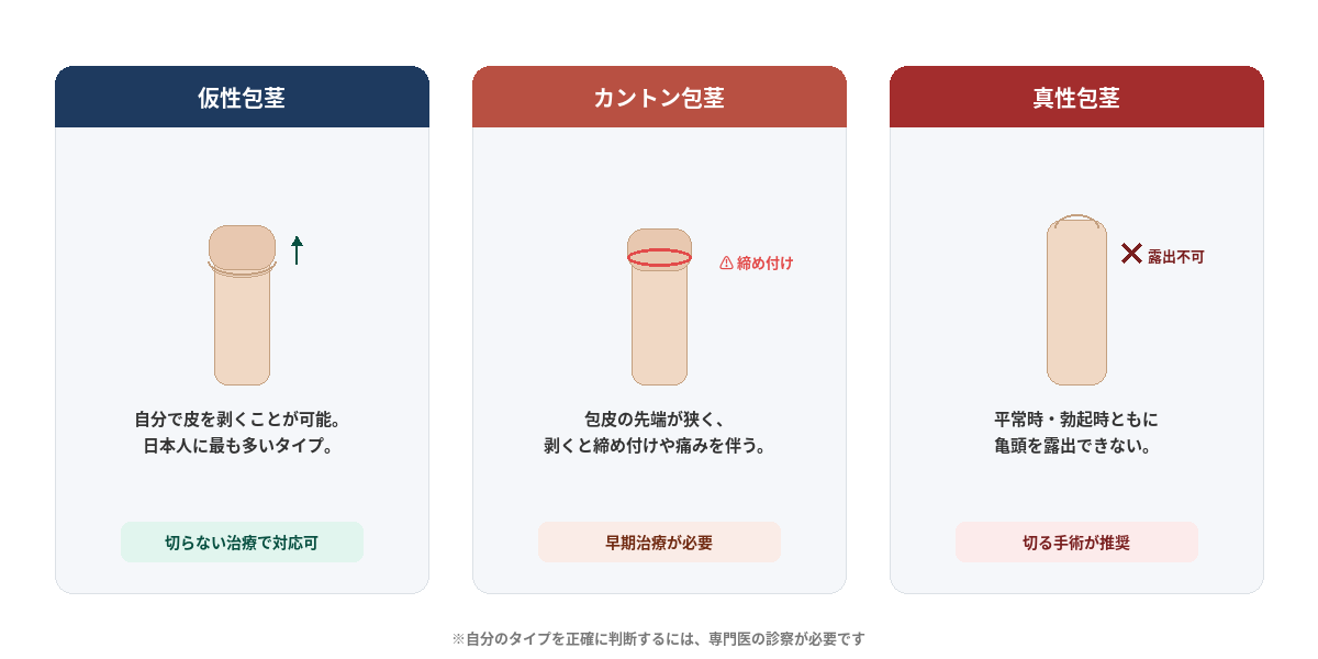 仮性包茎、カントン包茎、真性包茎の種類
