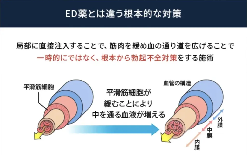 アトムクリニックED治療「Pstrong」のイメージ画像
