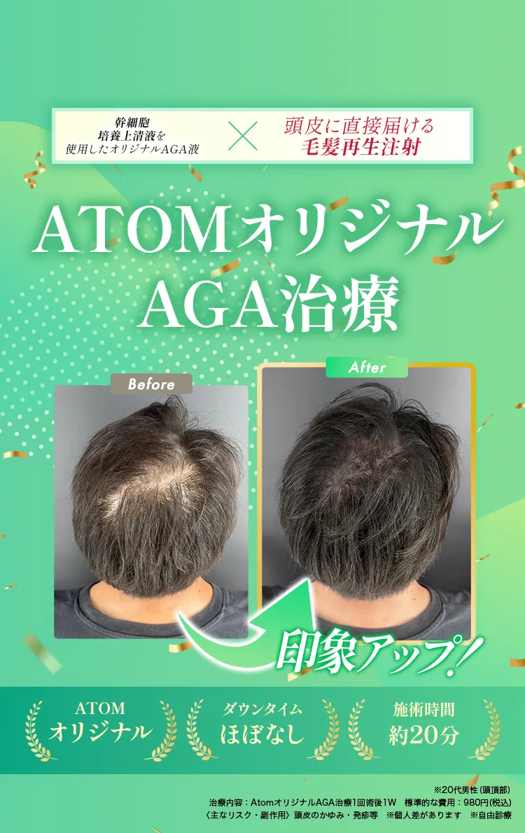 即日で隠すx隠しながら生やす1day薄毛治療オリジナルAGA治療